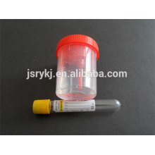 urine test tube